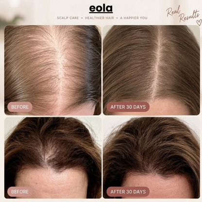 Eola™ Red Light Scalp Therapy Massager